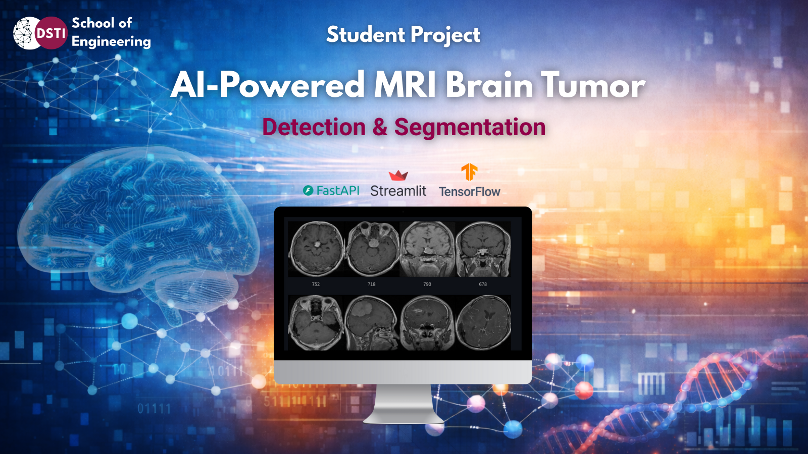 Early Brain Tumor Detection Using MRI Scans by a DSTI Student